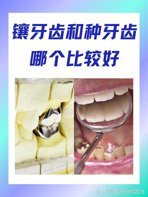 金华种牙哪里好？医院怎么选？求推荐靠谱的机构？-图2