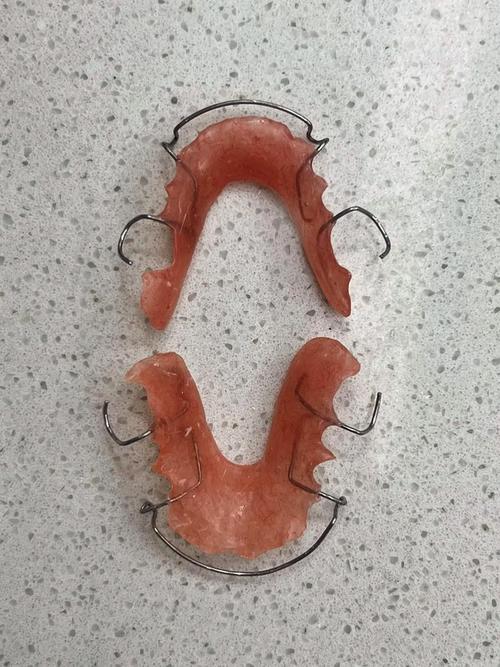 如何通过图片弯制正畸保持器?-图2 如何通过图片弯制正畸保持器?-图2