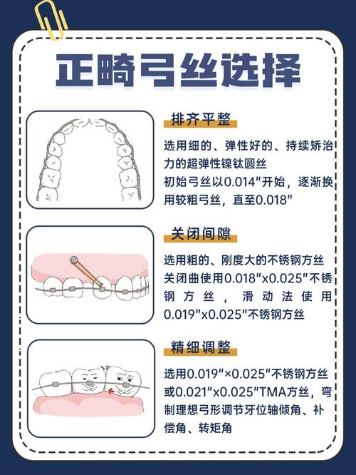 正畸直丝弓换丝顺序有何讲究？如何科学确定？-图2