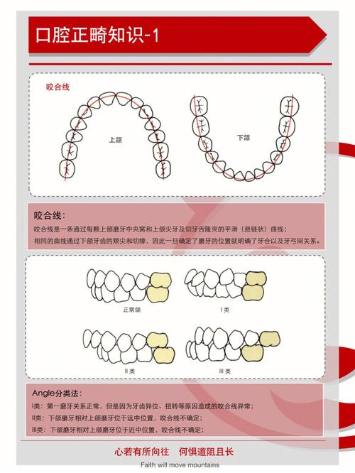 口腔正畸的十大常识-图3