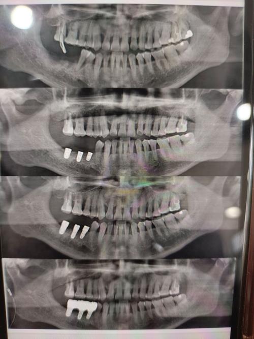 私立医院种的牙-图2