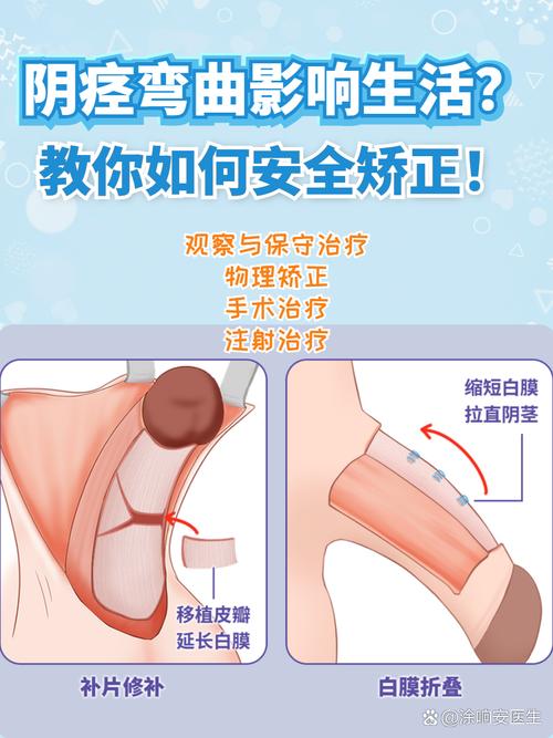 正畸控根簧弯制方法-图1