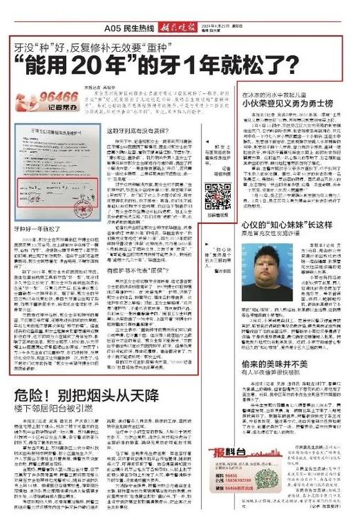 报纸种牙讲座靠谱吗？种牙前必看这些要点？-图3