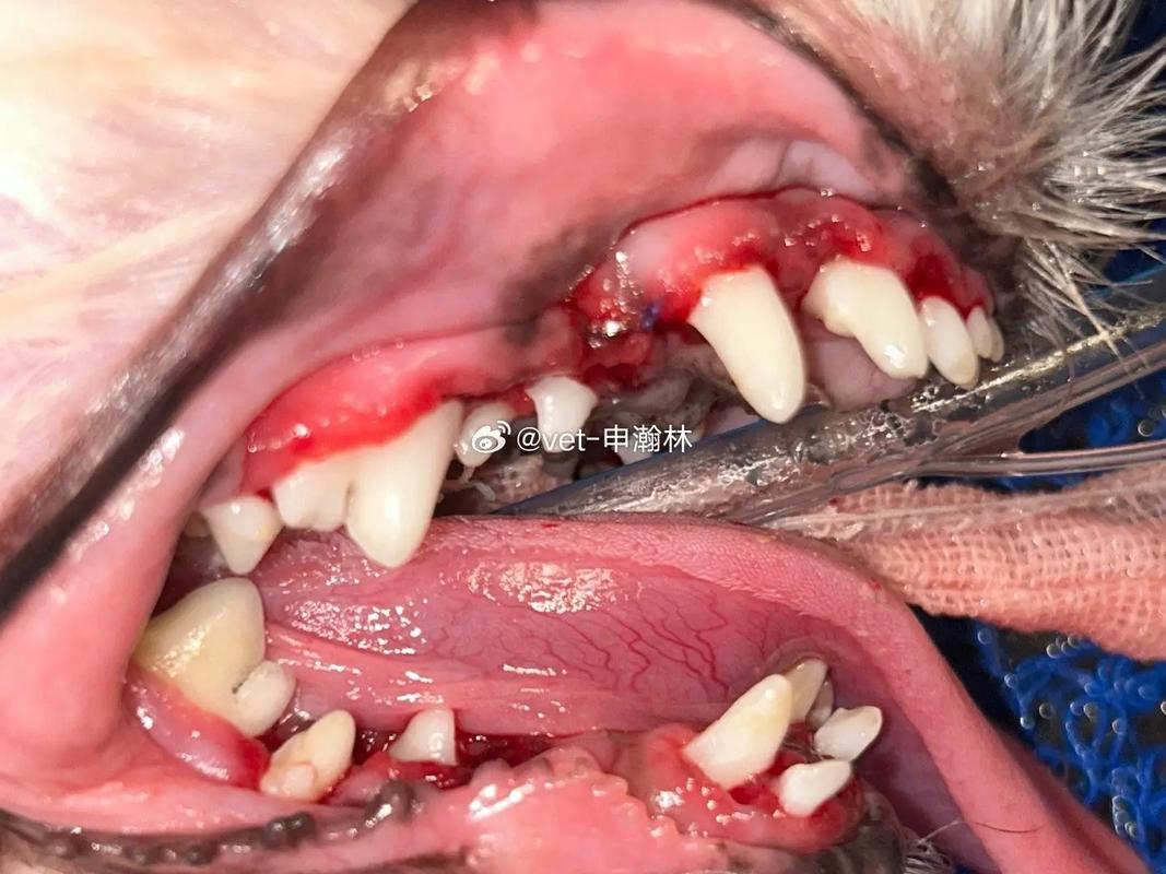 牙周病种牙例子-图3