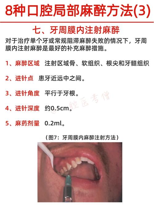 种牙麻醉 味觉-图1