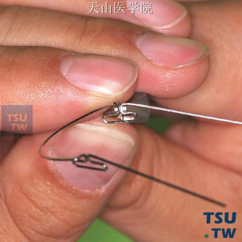 正畸t形曲弯制视频-图2