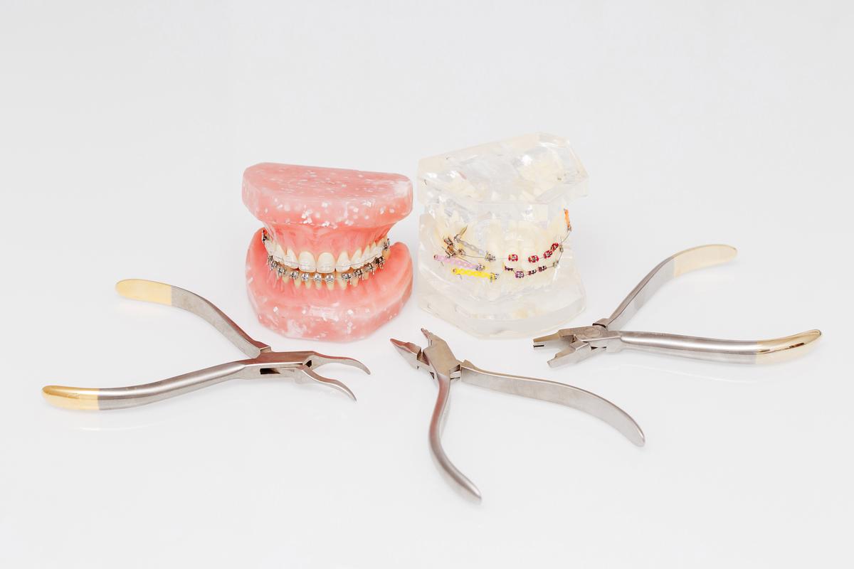 牙齿正畸添加的零件-图2