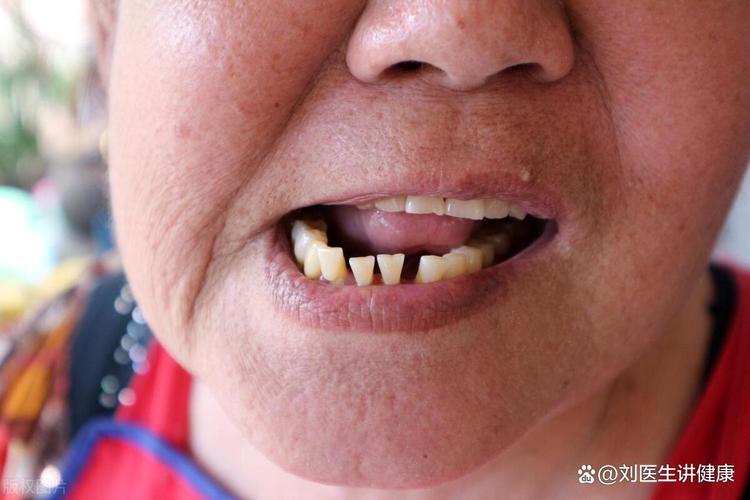 不种牙上牙松动-图3
