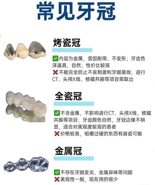 装牙还是种牙好-图1