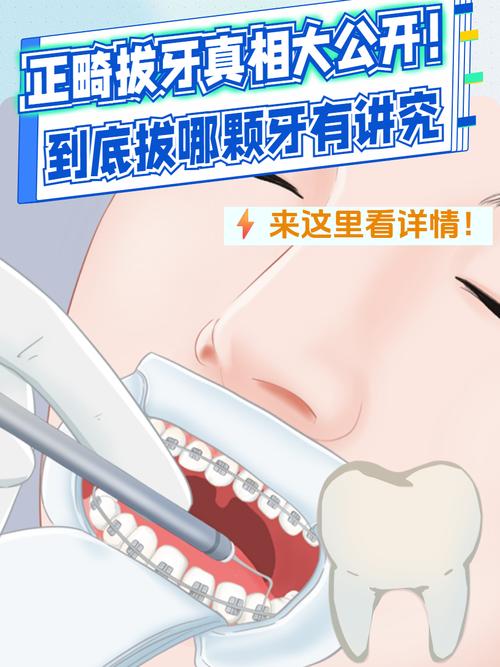 正畸拔7号牙会影响矫正效果吗?-图3 正畸拔7号牙会影响矫正效果吗?-图3