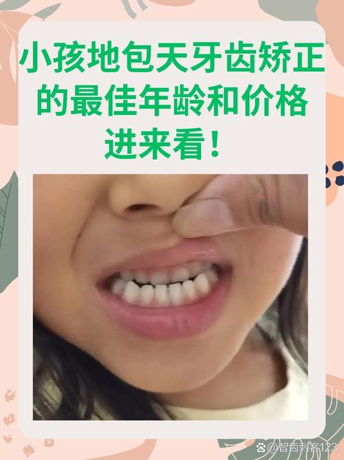 孩子地包天矫正几岁做效果最佳？-图2