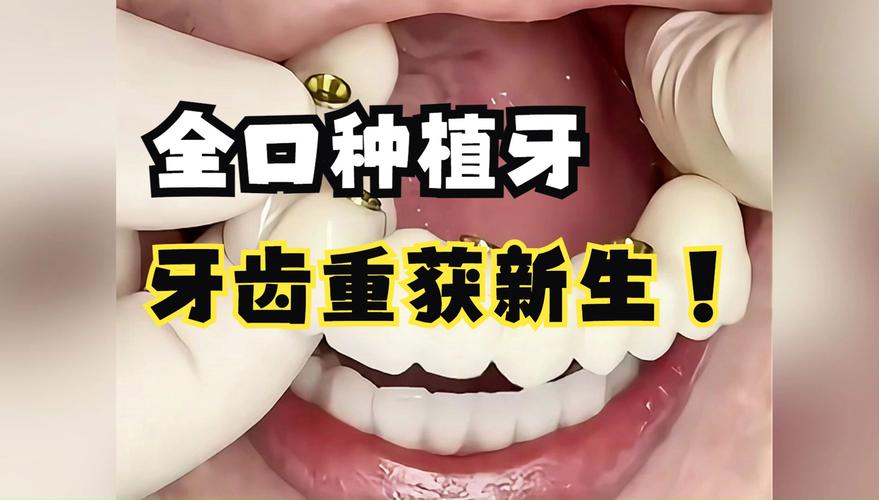 北京种植牙哪家好？价格、效果、流程怎么权衡？-图1