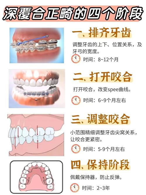 正畸怎么矫成开颌了-图3