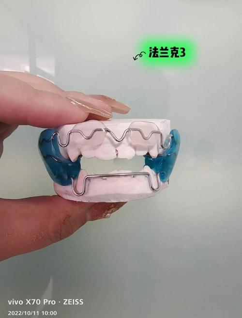 法兰克正畸视频教程，新手如何系统掌握核心技巧？-图1