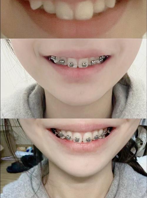 北京市口腔医院正畸-图2