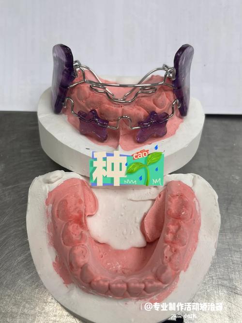 大鼠正畸牙移动力量如何影响牙齿移动效率？-图2