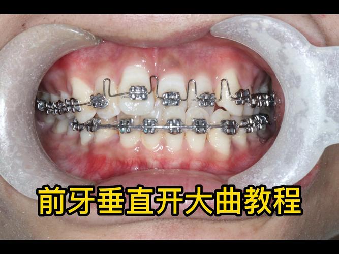 大鼠正畸牙移动力量如何影响牙齿移动效率？-图1