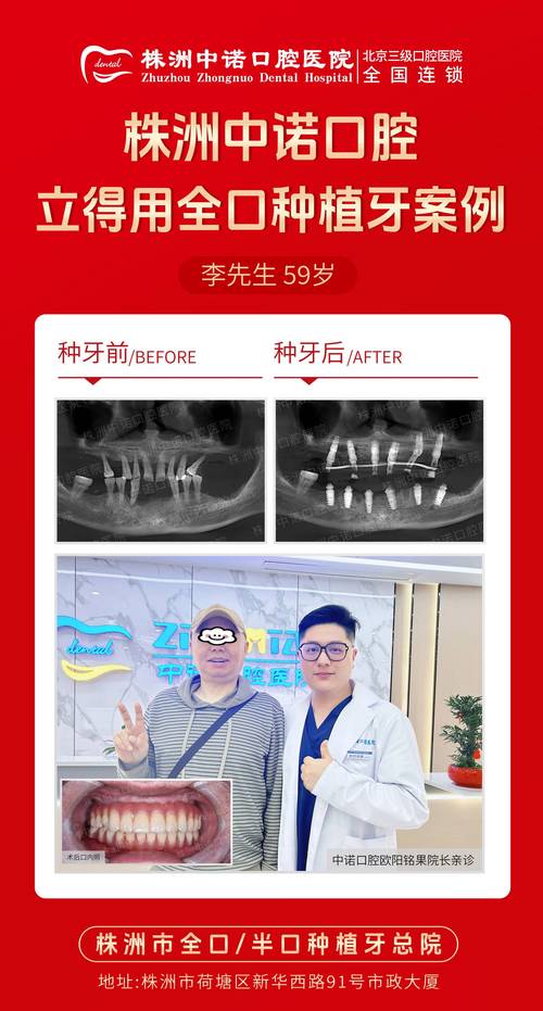 洛阳种牙哪家好-图2