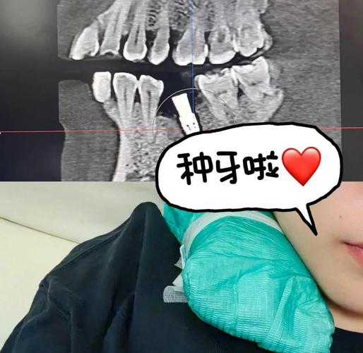 珠海种牙哪里好?求推荐技术好、口碑佳的靠谱医院-图2 珠海种牙哪里好?求推荐技术好、口碑佳的靠谱医院-图2
