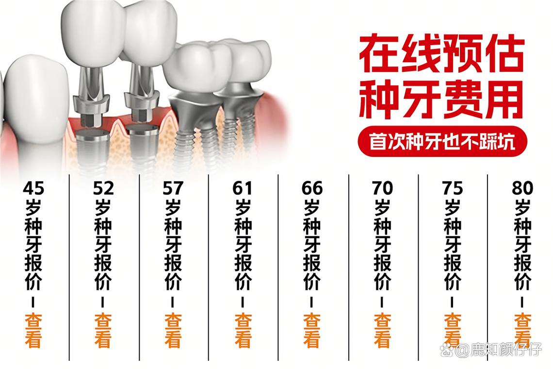 珠海种牙哪里好?求推荐技术好、口碑佳的靠谱医院-图1 珠海种牙哪里好?求推荐技术好、口碑佳的靠谱医院-图1