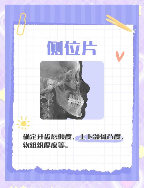 正畸拍什么片多少钱-图2 正畸拍什么片多少钱-图2