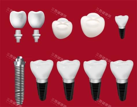 山西哪里种牙好-图2