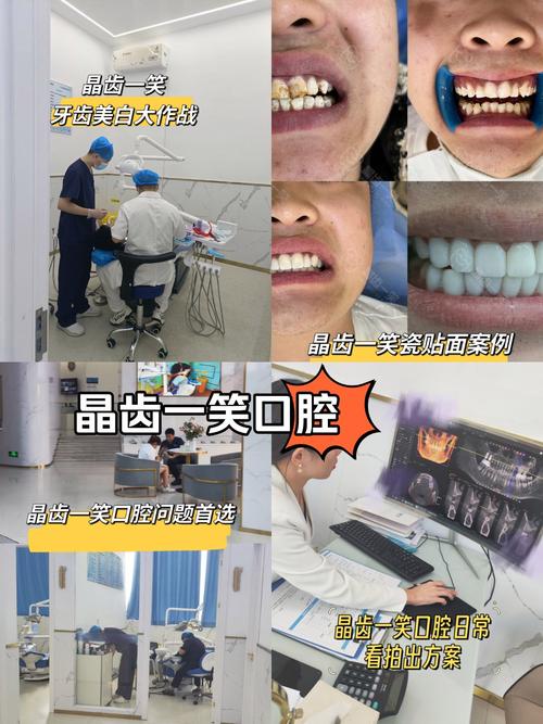 氟斑牙可以做正畸矫正吗?-图1 氟斑牙可以做正畸矫正吗?-图1