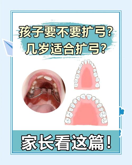 正畸不扩牙弓可以吗-图3