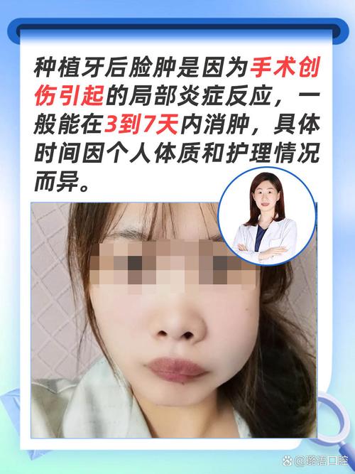 种牙后几天不疼-图2