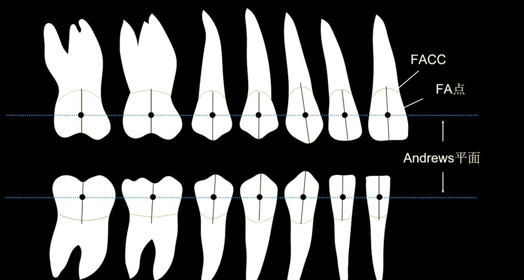 正畸时粘托槽的正确步骤是怎样的？-图2