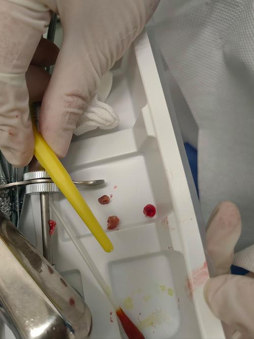 种牙过敏怎么办-图3