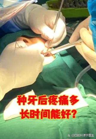 种牙打麻药疼吗-图1