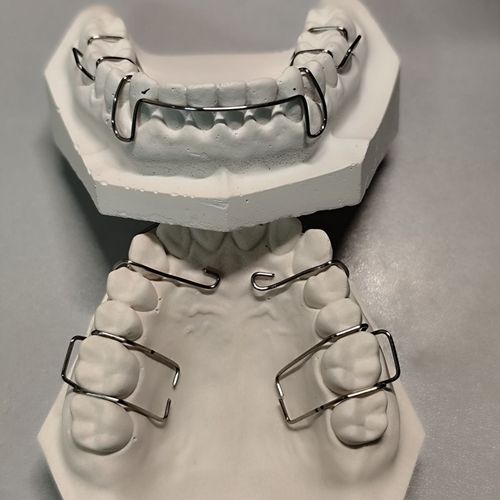 正畸双曲唇弓如何做-图3