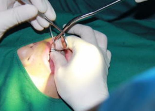 南京哪里种牙好?靠谱牙科机构怎么选?-图3 南京哪里种牙好?靠谱牙科机构怎么选?-图3