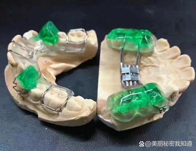 美国正畸矫治器公司-图3