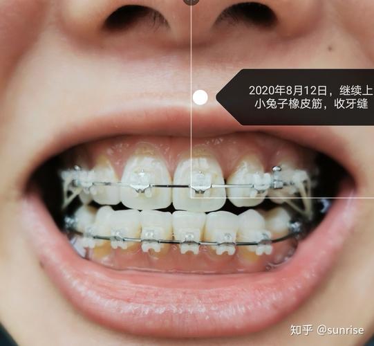北大口腔研究生正畸-图2