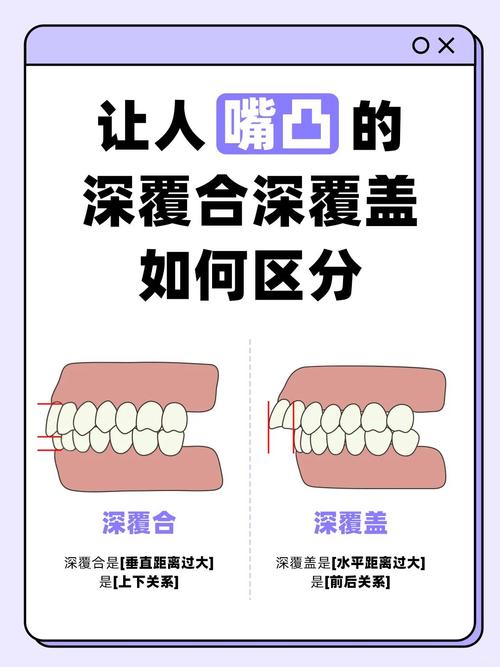 正畸可以治深覆合吗-图3