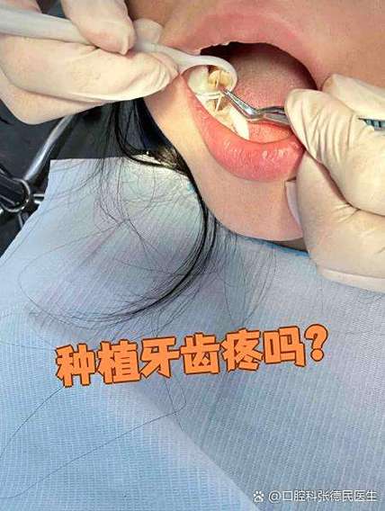 种牙麻药打哪里-图1