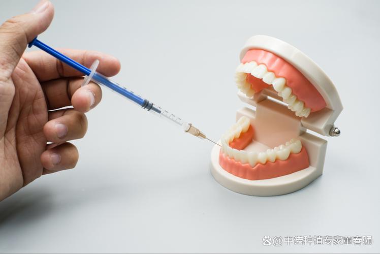 种牙麻药打哪里-图3