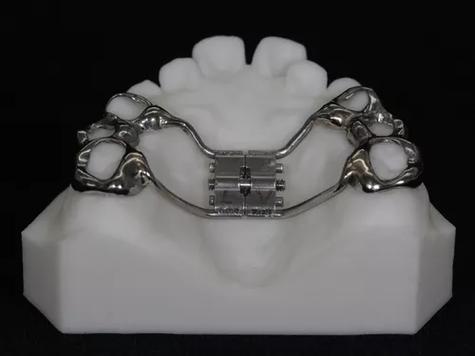 正畸螺旋扩弓器英文-图3