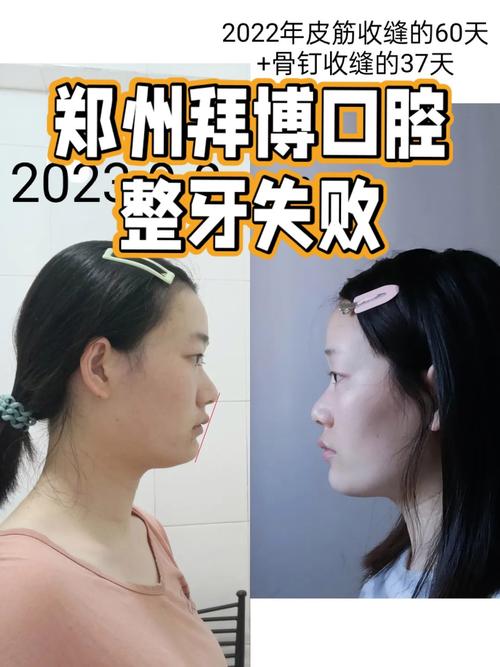 拜博口腔医院 正畸-图3