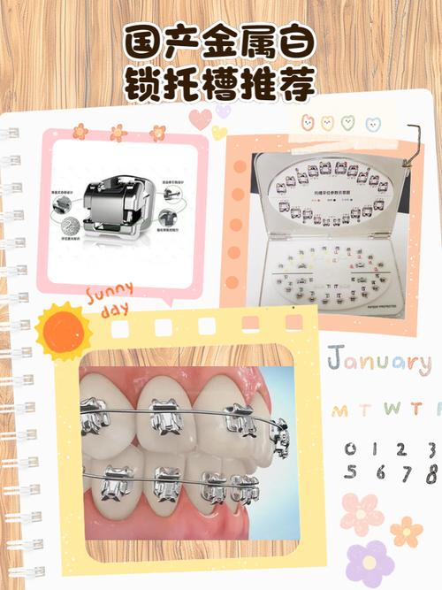 正畸自锁托槽的工具-图2