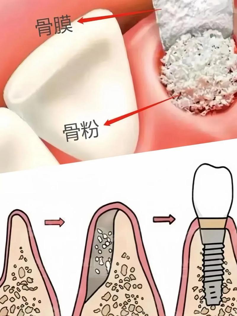 种牙骨粉是什么-图2