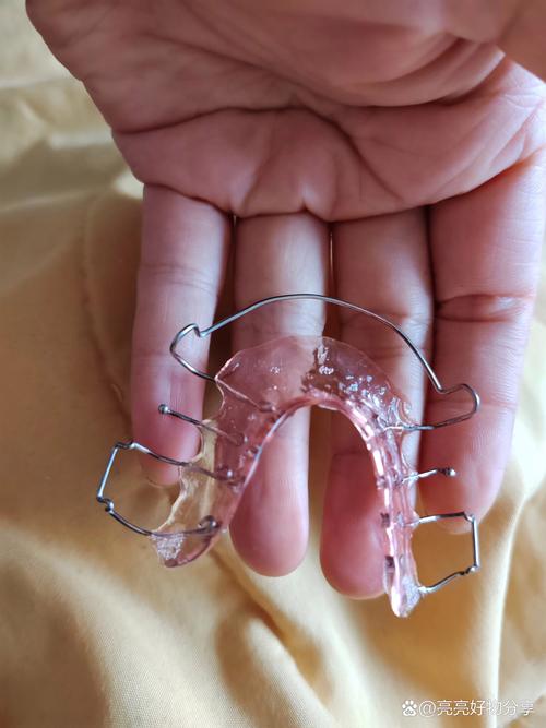 正畸舌侧保持器图片长啥样？看图了解佩戴形态与效果-图3