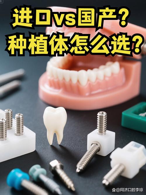 种牙什么样的好-图2