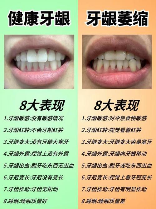 牙龈萎缩种牙吗-图1