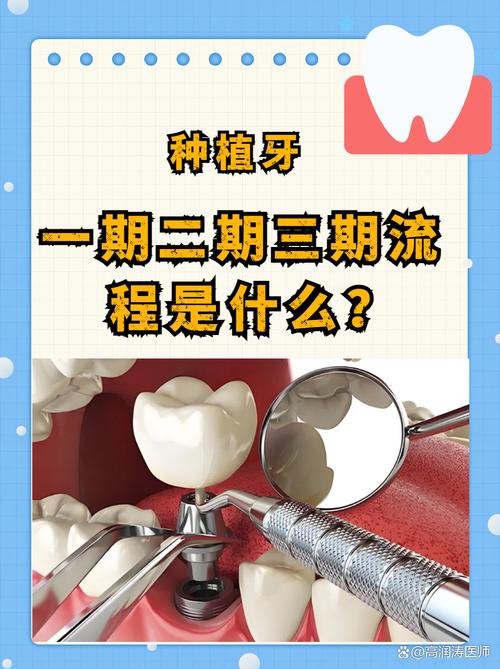 什么时候能种牙-图3