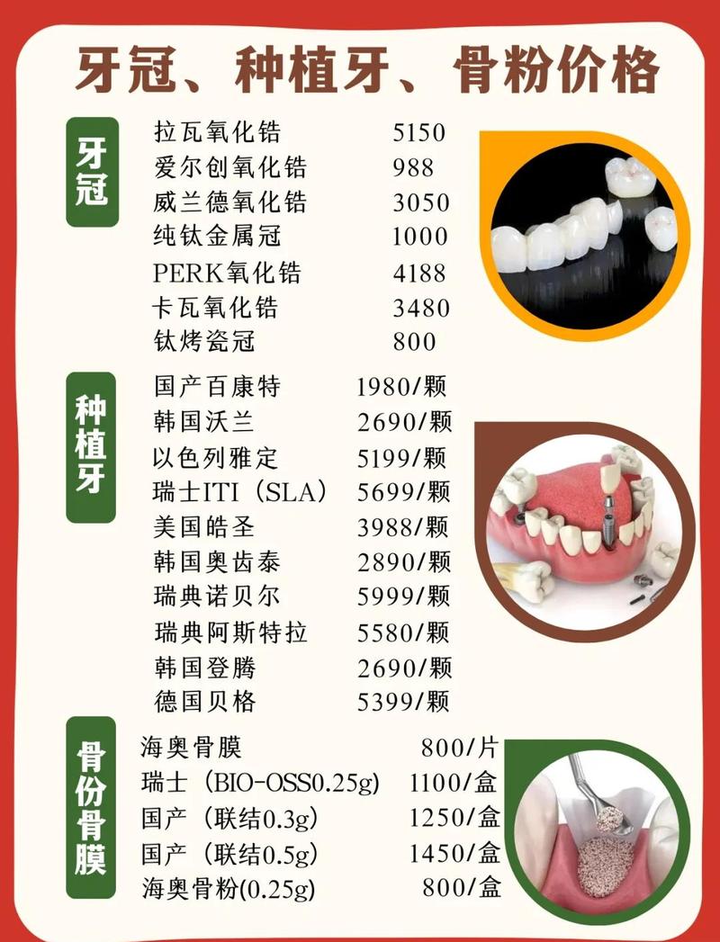 最好种牙材料怎么选?医生揭秘核心标准!-图3 最好种牙材料怎么选?医生揭秘核心标准!-图3