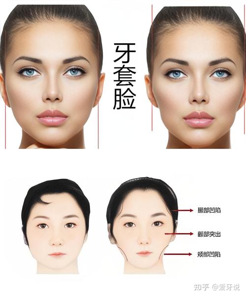 正畸颌垫会影响脸型吗？-图2