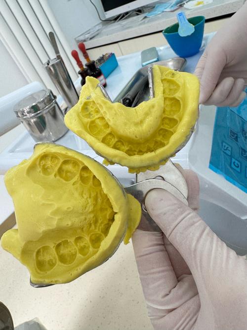 北京王府井口腔正畸-图3